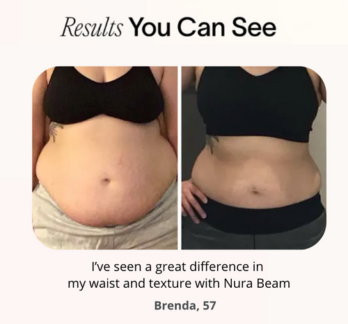 NuraSculpt™ Waist Band - Free Upgrade to Pro Plus