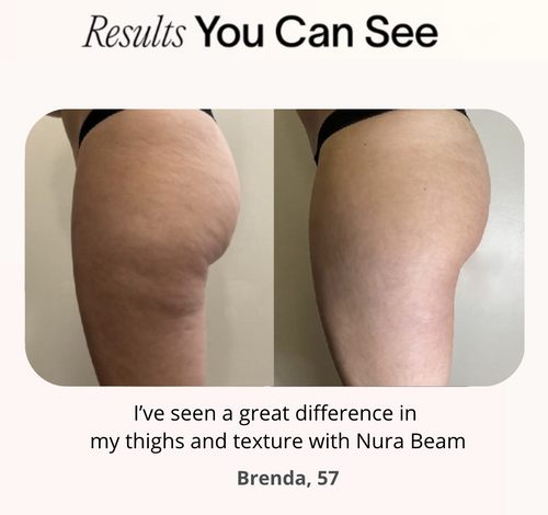 Thighs Wrap  - Free Upgrade to Pro Plus