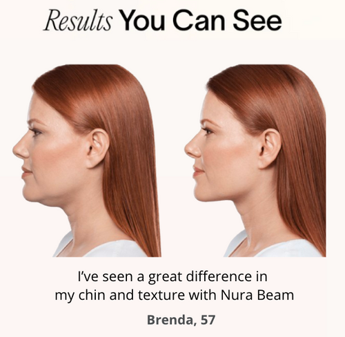 Neck Wrap  - Free Upgrade to Pro Plus